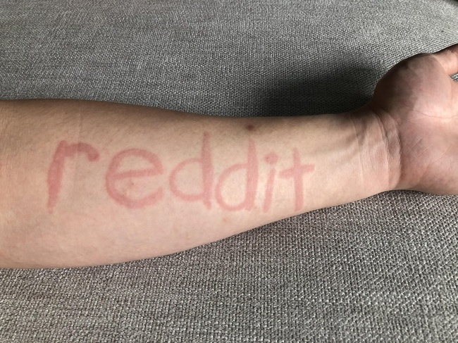 Удивительно5
