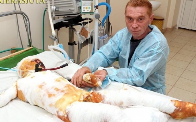 Чудом выжившего после удара током сына бросили родители Фото № 0 Чудом выжившего после удара током сына бросили родители Фото № 0