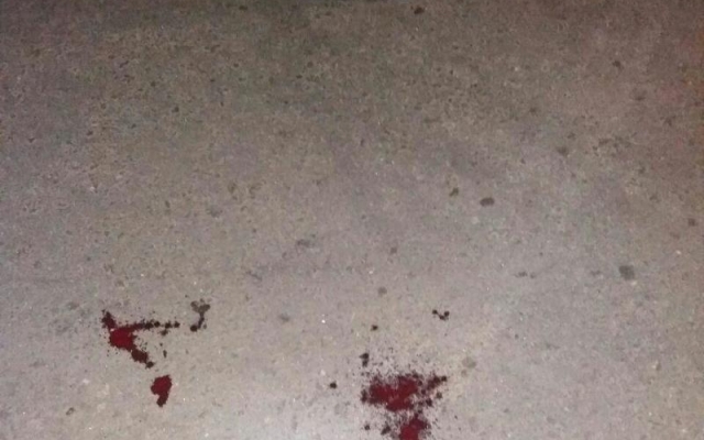ДТП в Кривом Роге: легковушка сбила мужчину Фото № 1 ДТП в Кривом Роге: легковушка сбила мужчину Фото № 1