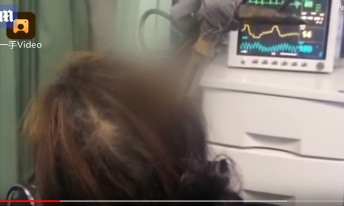 Китаянка з ножицями в голові доїхала до лікарні на автобусі і вижила: відео