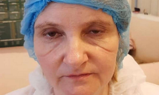 Со шрамами на лице от маски: каждый день украинские медики совершают подвиги (ФОТО)
