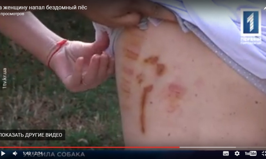 Подробности по происшествию: в Кривом Роге бездомный пёс прокусил женщине спину(ВИДЕО)