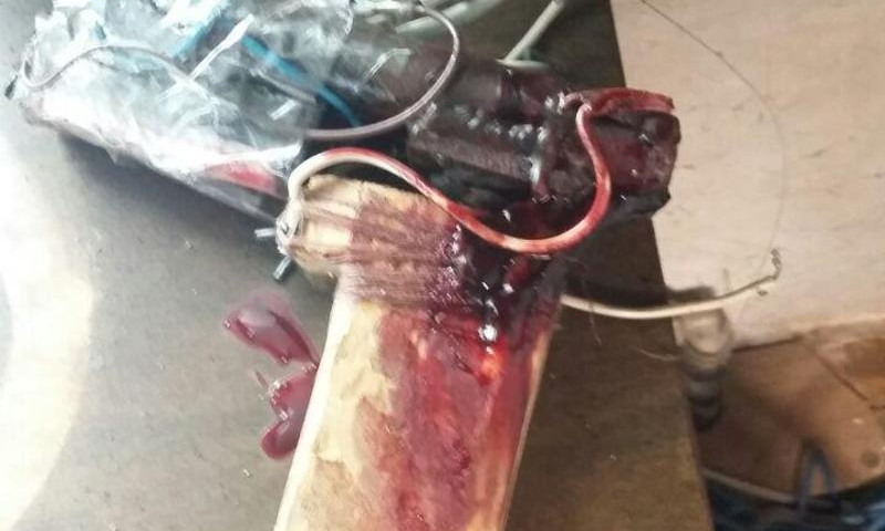 В Кривом Роге в квартире мужчина нашёл труп матери, после чего поджег квартиру и застрелился