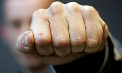 Жителю Кривого Рога грозит тюрьма за побитого копа
