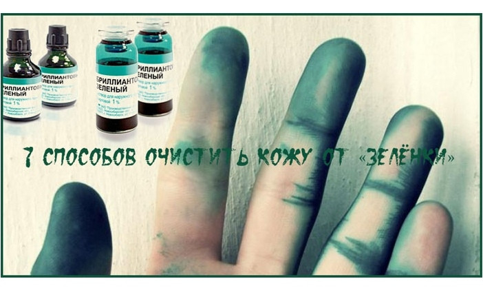 Криворожским депутатам: Вас облили зеленкой? 7 способов отмыться