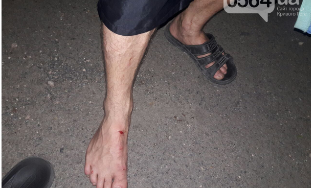 В Кривом Роге не повезло пешеходу, на него наехали, избили и ограбили