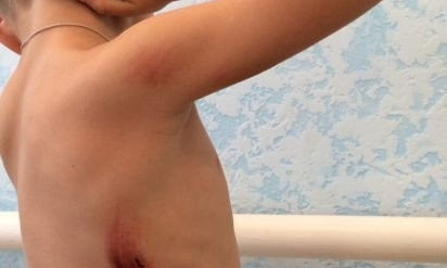 В Кривом Роге пятилетний ребенок провалился в канализационный люк