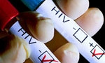  Опасный недуг: В Кривом Роге проживает более 24 тыс ВИЧ-инфицированных людей