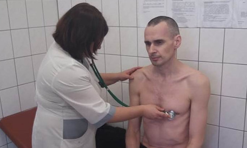 Тяжкий стан, розвинулась гіпоксія - адвокат розповів про тяжкий стан Сенцова