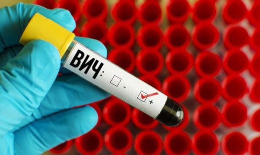 Медики изобрели лекарство, подавляющее развитие ВИЧ