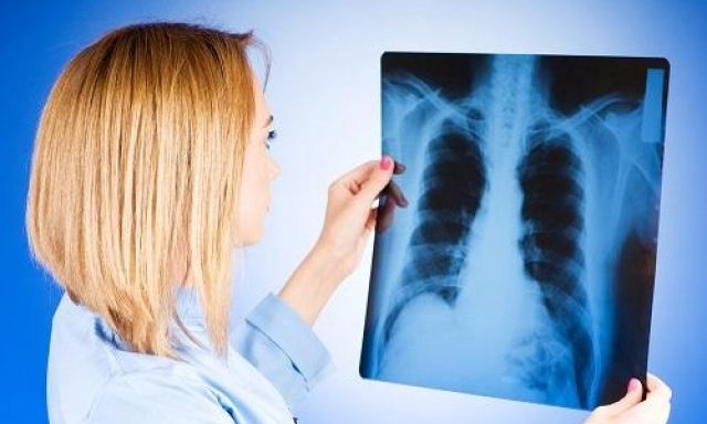 На Закарпатті зафіксували високу захвирюваність на туберкульоз