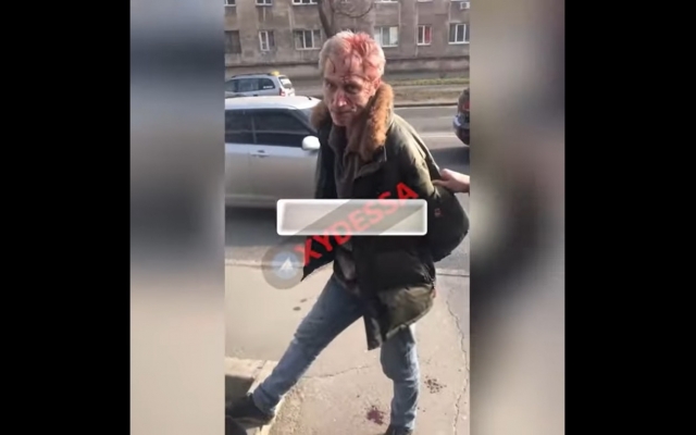 В Одессе посреди улицы стреляли в семью, гуляющую с ребенком: попали мужчине в глаз (ФОТО, ВИДЕО) Фото № 1 В Одессе посреди улицы стреляли в семью, гуляющую с ребенком: попали мужчине в глаз (ФОТО, ВИДЕО) Фото № 1