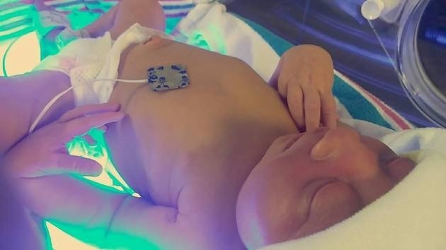 Женщина сознательно родила больного ребенка, чтобы отдать на органы Фото № 0 Женщина сознательно родила больного ребенка, чтобы отдать на органы Фото № 0